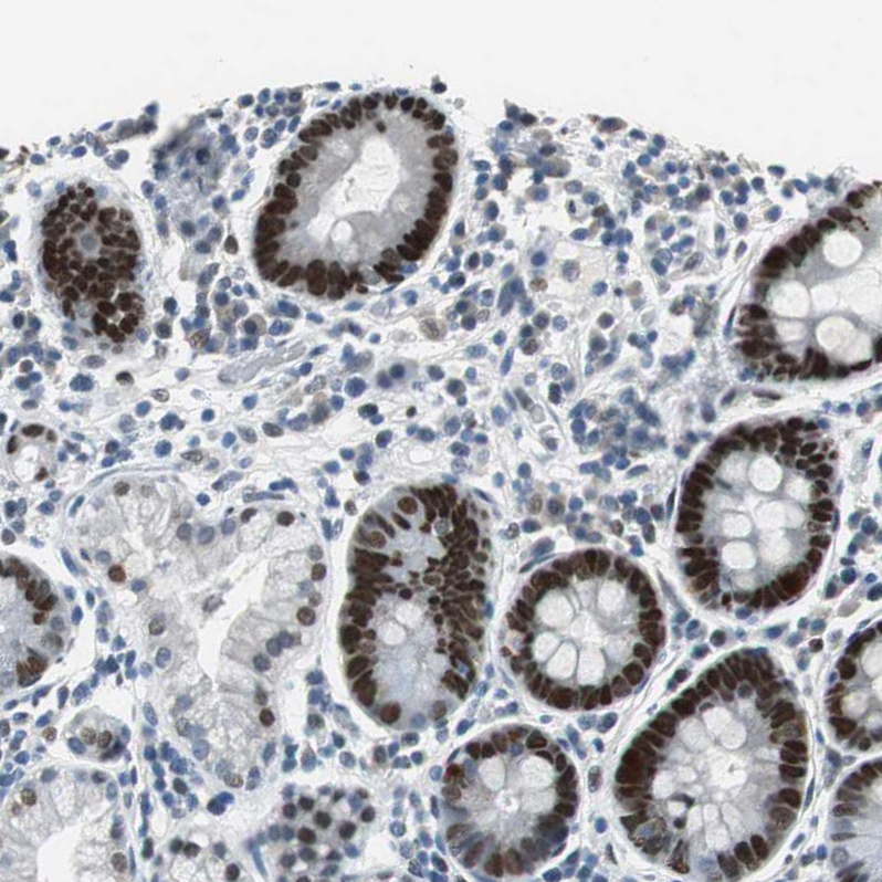 Immunohistochemistry (Formalin/PFA-fixed paraffin-embedded sections) - Anti-SGT1/ECD antibody (AB246881), expandable thumbnail