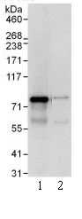 Immunoprecipitation - Anti-SGT1/ECD antibody (AB99293)