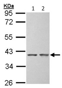 Western blot - Anti-SGTA antibody (AB96571), expandable thumbnail