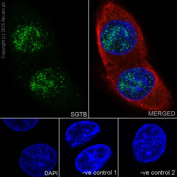 Immunocytochemistry/ Immunofluorescence - Anti-SGTB/SGT2 antibody [EPR17183] (AB202419)