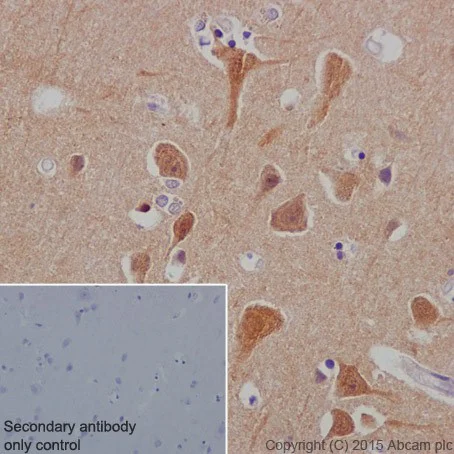 Immunohistochemistry (Formalin/PFA-fixed paraffin-embedded sections) - Anti-SGTB/SGT2 antibody [EPR17183] (AB202419)