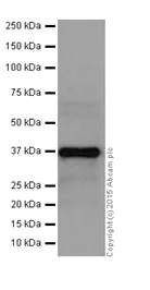 Western blot - Anti-SGTB/SGT2 antibody [EPR17183] (AB202419)
