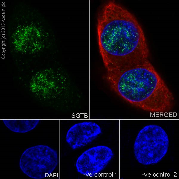 Immunocytochemistry/ Immunofluorescence - Anti-SGTB/SGT2 antibody [EPR17183] - BSA and Azide free (AB251369)