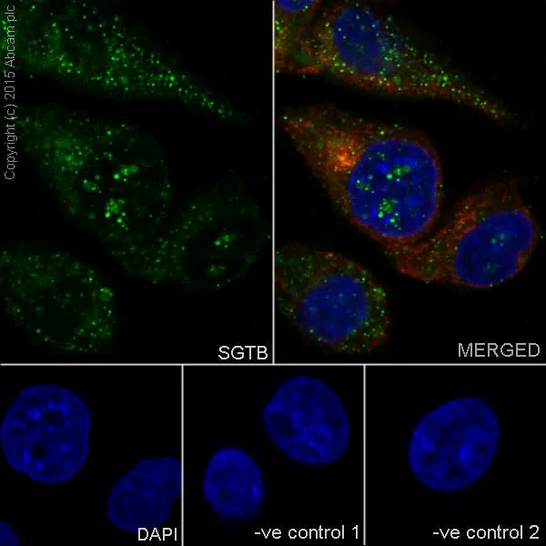 Immunocytochemistry/ Immunofluorescence - Anti-SGTB/SGT2 antibody [EPR17183] - BSA and Azide free (AB251369)