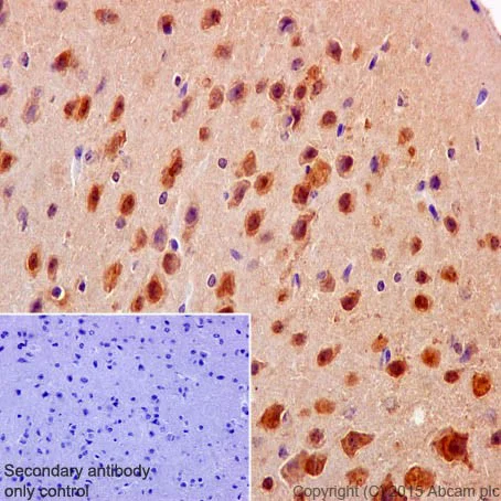Immunohistochemistry (Formalin/PFA-fixed paraffin-embedded sections) - Anti-SGTB/SGT2 antibody [EPR17183] - BSA and Azide free (AB251369)