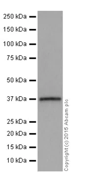 Western blot - Anti-SGTB/SGT2 antibody [EPR17183] - BSA and Azide free (AB251369)