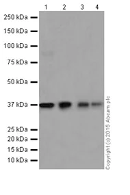 Western blot - Anti-SGTB/SGT2 antibody [EPR17183] - BSA and Azide free (AB251369)