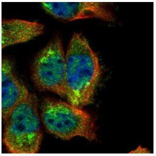 Immunocytochemistry/ Immunofluorescence - Anti-SH2B1/PSM antibody (AB228828)