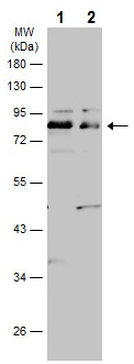 Western blot - Anti-SH2B1/PSM antibody (AB228828)