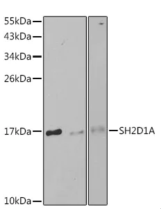 Western blot - Anti-SH2D1A/SAP antibody (AB185810)