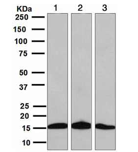 Western blot - Anti-SH2D1A/SAP antibody [EPR3168] (AB109120)