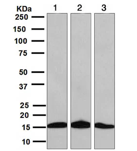 Western blot - Anti-SH2D1A/SAP antibody [EPR3168] (AB109120)
