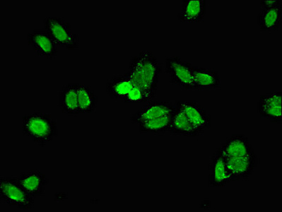 Immunocytochemistry/ Immunofluorescence - Anti-SH2D1B antibody (AB222814), expandable thumbnail