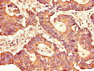 Immunohistochemistry (Formalin/PFA-fixed paraffin-embedded sections) - Anti-SH2D1B antibody (AB222814), expandable thumbnail