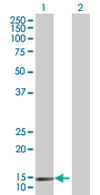 Western blot - Anti-SH2D1B antibody (AB67417), expandable thumbnail