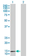 Western blot - Anti-SH2D1B antibody (AB67417)
