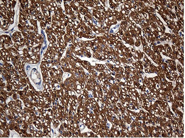Immunohistochemistry (Formalin/PFA-fixed paraffin-embedded sections) - Anti-SH3BGR antibody [OTI1G7] (AB279375)