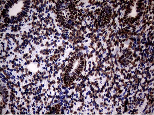 Immunohistochemistry (Formalin/PFA-fixed paraffin-embedded sections) - Anti-SH3BGRL antibody [OTI8F7] (AB279371), expandable thumbnail