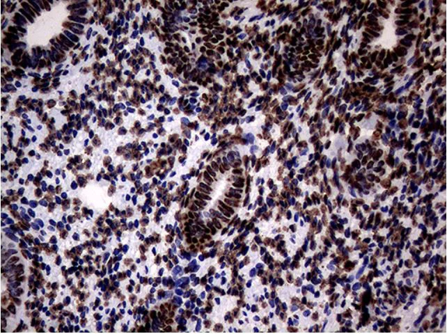 Immunohistochemistry (Formalin/PFA-fixed paraffin-embedded sections) - Anti-SH3BGRL antibody [OTI8F7] (AB279371)