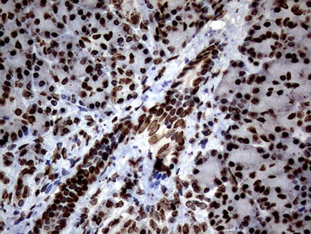 Immunohistochemistry (Formalin/PFA-fixed paraffin-embedded sections) - Anti-SH3BGRL antibody [OTI8F7] (ab279371), expandable thumbnail