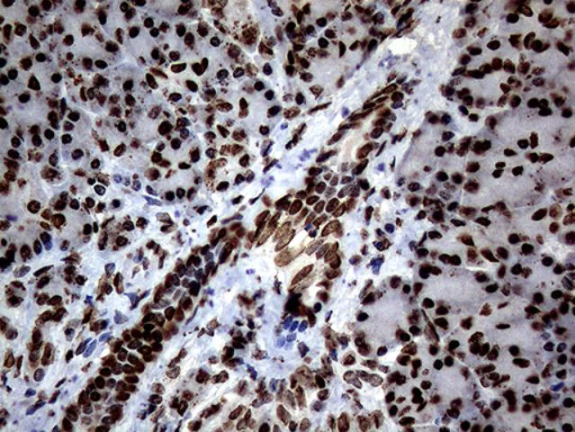 Immunohistochemistry (Formalin/PFA-fixed paraffin-embedded sections) - Anti-SH3BGRL antibody [OTI8F7] (AB279371)