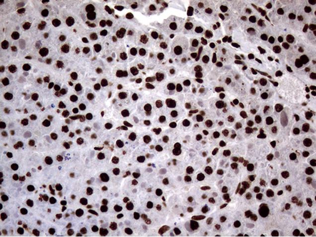 Immunohistochemistry (Formalin/PFA-fixed paraffin-embedded sections) - Anti-SH3BGRL antibody [OTI8F7] (ab279371), expandable thumbnail
