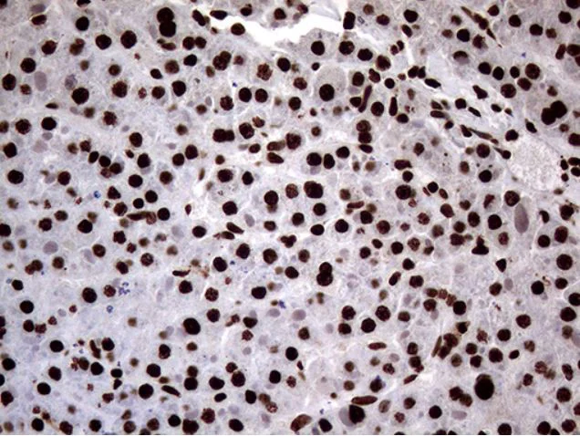 Immunohistochemistry (Formalin/PFA-fixed paraffin-embedded sections) - Anti-SH3BGRL antibody [OTI8F7] (AB279371)