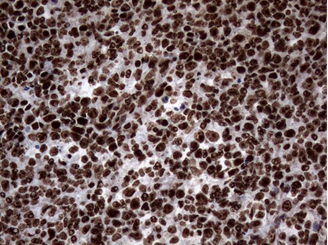 Immunohistochemistry (Formalin/PFA-fixed paraffin-embedded sections) - Anti-SH3BGRL antibody [OTI8F7] (AB279371), expandable thumbnail