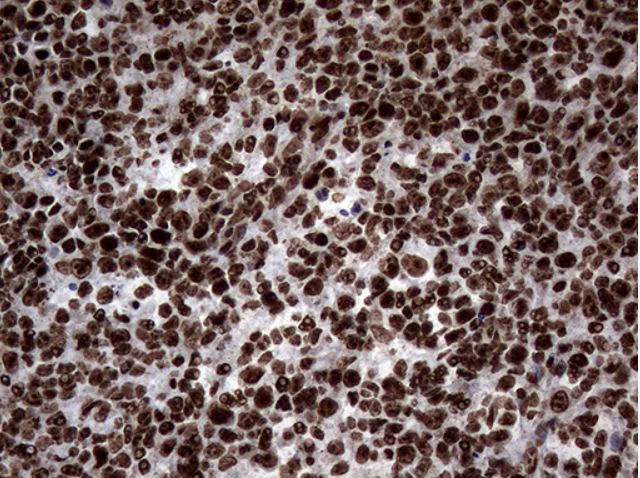 Immunohistochemistry (Formalin/PFA-fixed paraffin-embedded sections) - Anti-SH3BGRL antibody [OTI8F7] (AB279371)