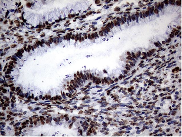 Immunohistochemistry (Formalin/PFA-fixed paraffin-embedded sections) - Anti-SH3BGRL antibody [OTI8F7] (AB279371), expandable thumbnail