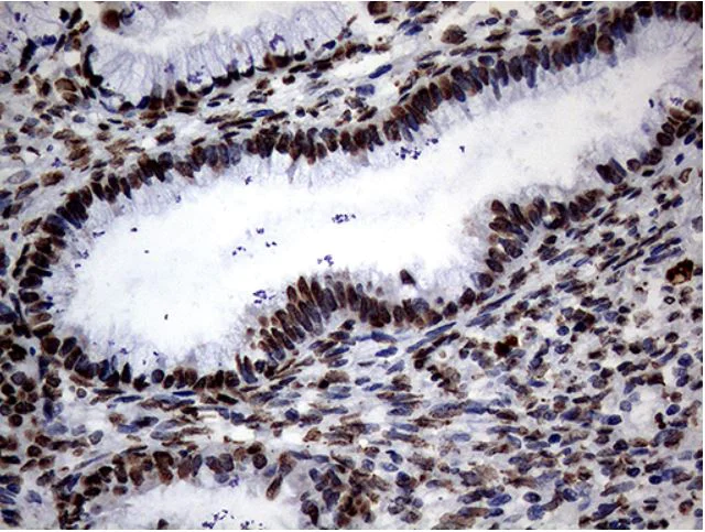 Immunohistochemistry (Formalin/PFA-fixed paraffin-embedded sections) - Anti-SH3BGRL antibody [OTI8F7] (AB279371)