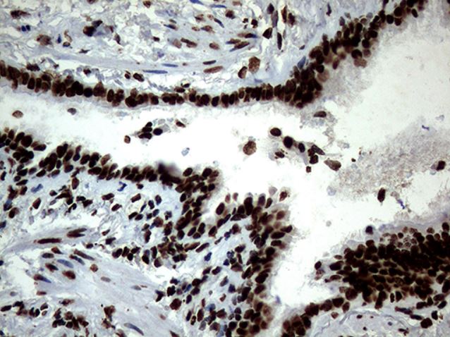 Immunohistochemistry (Formalin/PFA-fixed paraffin-embedded sections) - Anti-SH3BGRL antibody [OTI8F7] (ab279371), expandable thumbnail