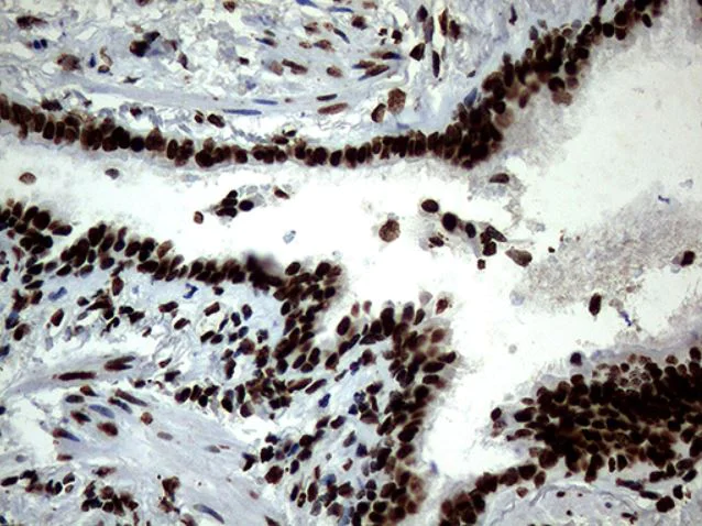 Immunohistochemistry (Formalin/PFA-fixed paraffin-embedded sections) - Anti-SH3BGRL antibody [OTI8F7] (AB279371)