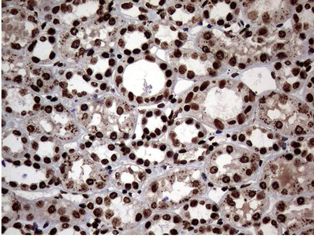 Immunohistochemistry (Formalin/PFA-fixed paraffin-embedded sections) - Anti-SH3BGRL antibody [OTI8F7] (AB279371)