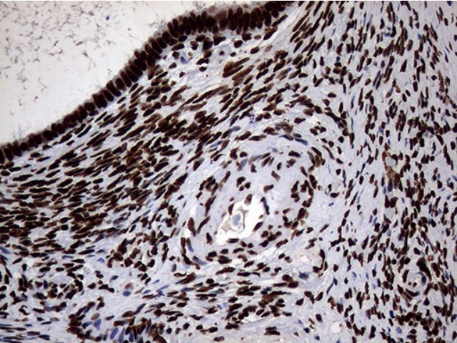 Immunohistochemistry (Formalin/PFA-fixed paraffin-embedded sections) - Anti-SH3BGRL antibody [OTI8F7] (ab279371), expandable thumbnail