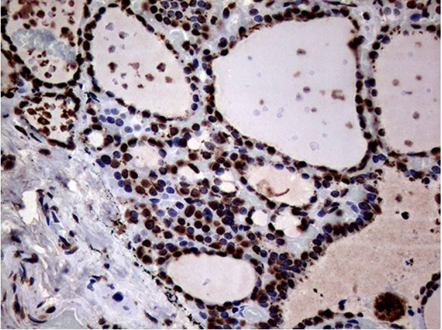 Immunohistochemistry (Formalin/PFA-fixed paraffin-embedded sections) - Anti-SH3BGRL antibody [OTI8F7] (AB279371), expandable thumbnail