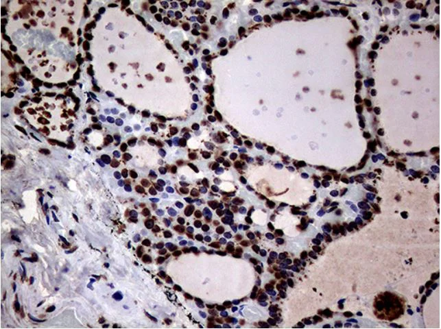 Immunohistochemistry (Formalin/PFA-fixed paraffin-embedded sections) - Anti-SH3BGRL antibody [OTI8F7] (AB279371)