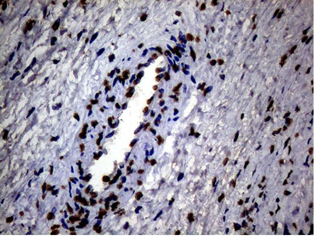 Immunohistochemistry (Formalin/PFA-fixed paraffin-embedded sections) - Anti-SH3BGRL antibody [OTI8F7] (AB279371)