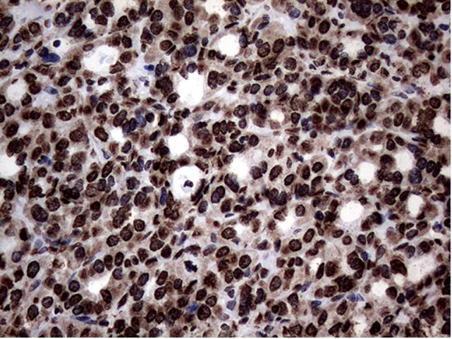 Immunohistochemistry (Formalin/PFA-fixed paraffin-embedded sections) - Anti-SH3BGRL antibody [OTI8F7] (AB279371), expandable thumbnail