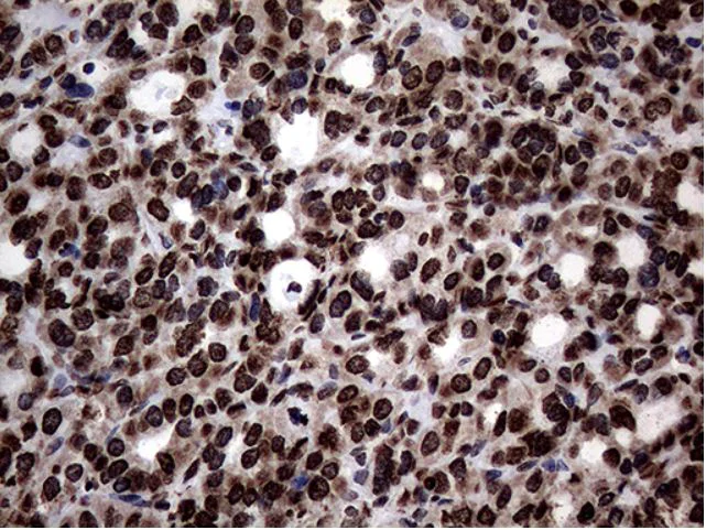 Immunohistochemistry (Formalin/PFA-fixed paraffin-embedded sections) - Anti-SH3BGRL antibody [OTI8F7] (AB279371)