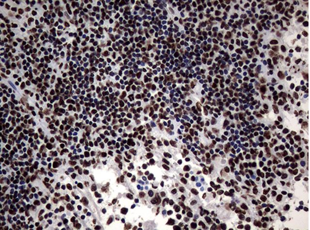Immunohistochemistry (Formalin/PFA-fixed paraffin-embedded sections) - Anti-SH3BGRL antibody [OTI8F7] (ab279371), expandable thumbnail