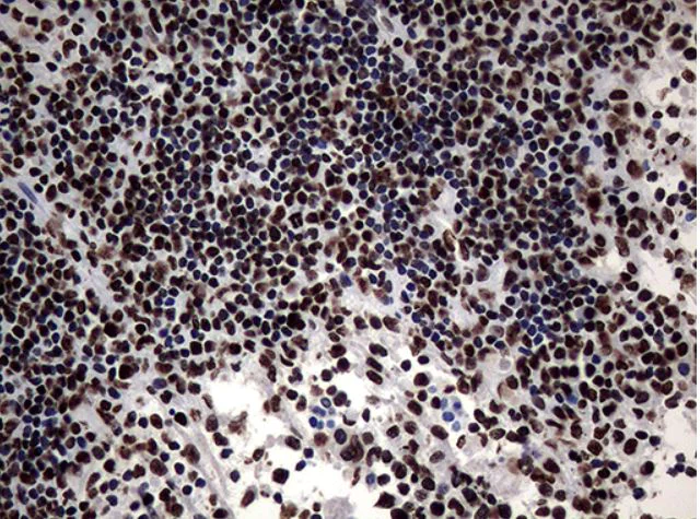 Immunohistochemistry (Formalin/PFA-fixed paraffin-embedded sections) - Anti-SH3BGRL antibody [OTI8F7] (AB279371)