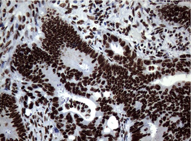 Immunohistochemistry (Formalin/PFA-fixed paraffin-embedded sections) - Anti-SH3BGRL antibody [OTI8F7] (ab279371), expandable thumbnail