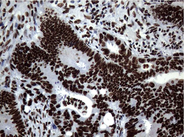 Immunohistochemistry (Formalin/PFA-fixed paraffin-embedded sections) - Anti-SH3BGRL antibody [OTI8F7] (AB279371)