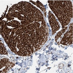 Immunohistochemistry (Formalin/PFA-fixed paraffin-embedded sections) - Anti-SH3BGRL3 antibody (AB122138), expandable thumbnail