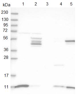 Western blot - Anti-SH3BGRL3 antibody (AB122138), expandable thumbnail