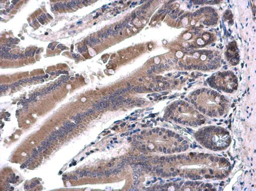 Immunohistochemistry (Formalin/PFA-fixed paraffin-embedded sections) - Anti-SH3BP1 antibody (AB227548)