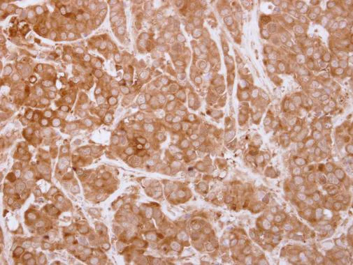 Immunohistochemistry (Formalin/PFA-fixed paraffin-embedded sections) - Anti-SH3BP1 antibody (AB227548)