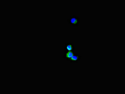Immunocytochemistry/ Immunofluorescence - Anti-SH3BP5 antibody (AB222860)