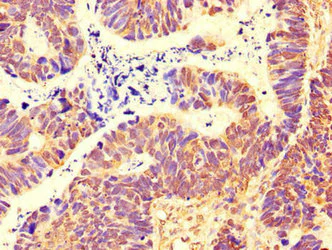 Immunohistochemistry (Formalin/PFA-fixed paraffin-embedded sections) - Anti-SH3BP5 antibody (AB222860)